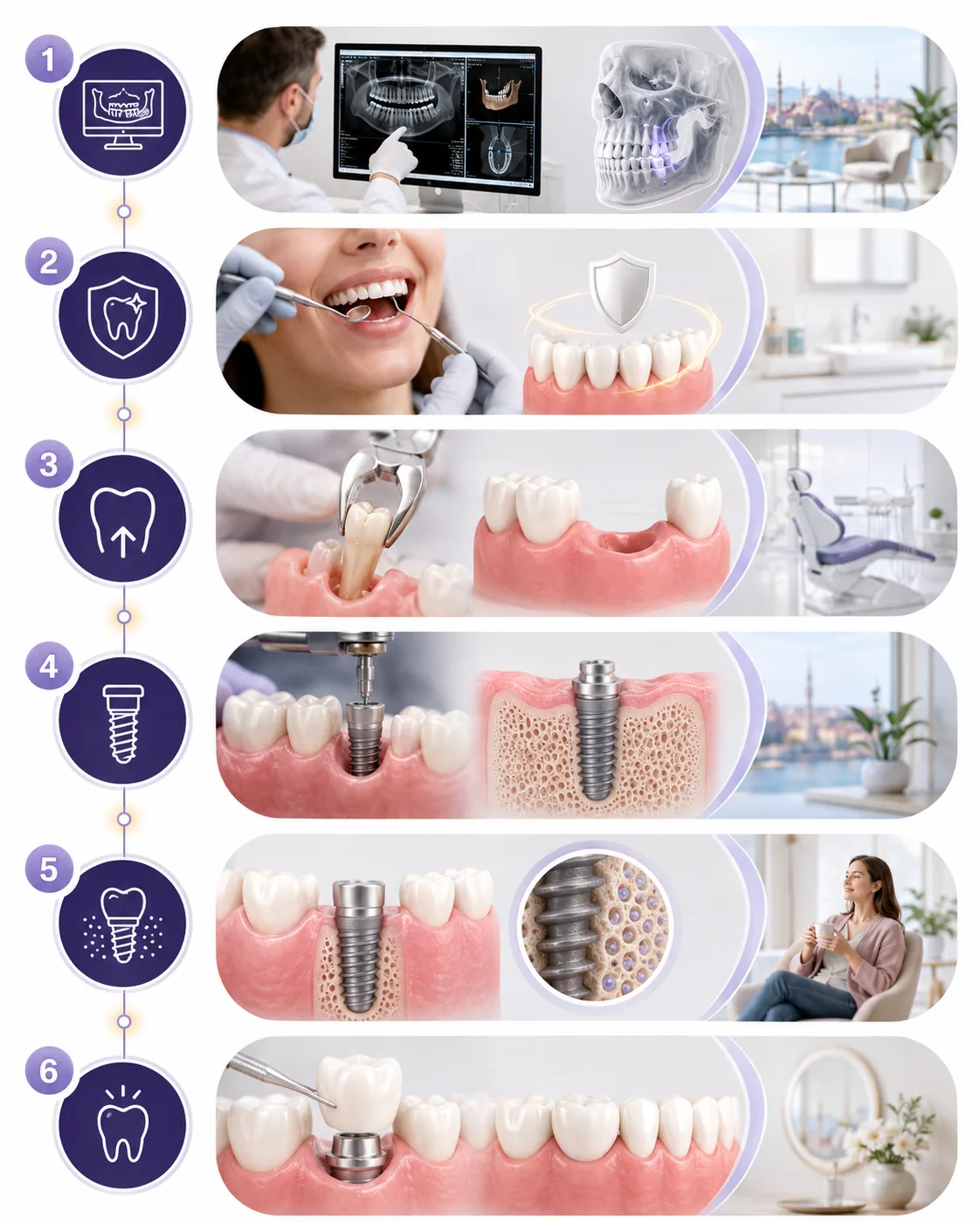Step-by-step stages of dental implant treatment from assessment to final restoration